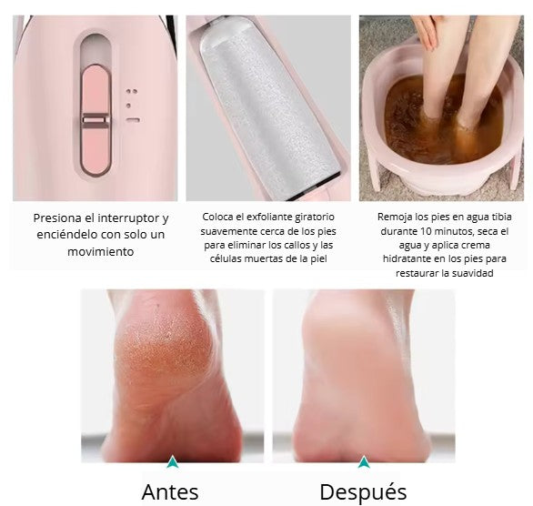 DermixPro Removedora de callos